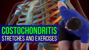 Costochondritis Chiropractor Nyc East Village Gramercy Park