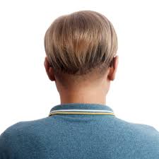 The most important one to remember is that of hair loss from tension and pulling, says dr. Buy H Bwig Men Short Toppers Hairpiece Clip In Crown Hair Extensions For Covering White Loss Hair Toupee Blonde Online In Indonesia B07tsm44r2
