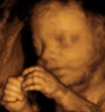 Maybe you would like to learn more about one of these? 4d Ultrasound Overview Video Life Issueslife Issues