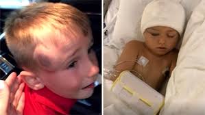 4-Year-Old Nearly Dies After Being Struck in Head With Golf Ball