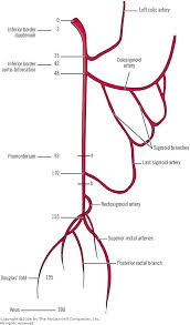 Collateral Pathway In Aortoiliac Occlusive Disease Google Search Anatomiya