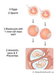 Twins And Multiple Babies