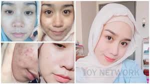 Wajah yang kelihatan awet muda sememangnya menjadi impian ramai orang. Umur 30 Tapi Wajah Awet Muda Macam 19 Tahun Rahsia Wanita Ini Amalkan Susu Kunyit Badam Madu Yoy Network