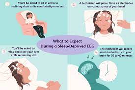 But how accurate are these tests in real life? How A Sleep Deprived Eeg May Diagnose Seizures