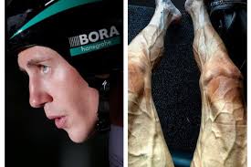 The 2021 tour de france will start in brest in brittany, on saturday, june 26 having originally been scheduled for a grand départ in. Cyclist Shares Horrifying Picture Showing Impact Of Tour De France On His Legs Daily Record