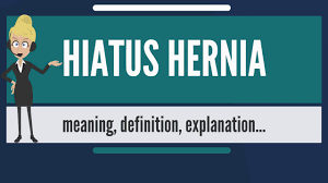 What Is Hiatus Hernia What Does Hiatus Hernia Mean Hiatus Hernia Meaning Definition Explanation Youtube