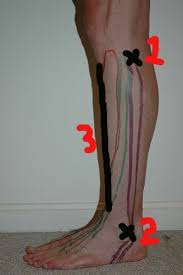 How To Get Rid Of Shin Splints Panosundaki Pin