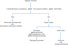 Management Of Acute Sigmoid Volvulus A Tunisian Experience Sciencedirect