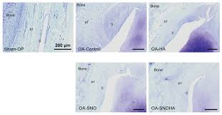 Nutrients Free Full Text Shea Nut Oil Extracts Enhance The Intra Articular Sodium Hyaluronate Effectiveness On Surgically Induced Oa Progression In Rats Html