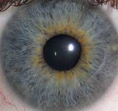 Central heterochromia is more common than the other types, but not nearly as visually striking. File Human Eye Detail From Eye Central Heterochromia Crop And Lighter Cropped Jpg Wikimedia Commons