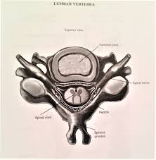 Here is brief of the topology i have and will be. Broken Back Lawyer In Kansas City Experienced Attorneys With Results
