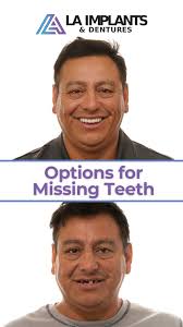 Explore your options for missing teeth, from single tooth replacements to  full arch restorations like all-on-4, all-on-6, and all-on-x. Whether  you're missing one tooth or several, advanced implant ...