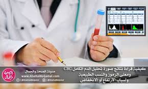 كيفية قراءة نتائج صورة فحص تحليل الدم الكامل Cbc ومعنى الرموز والنسب الطبيعية وأسباب الارتفاع أو الانخفاض