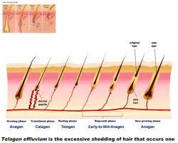 How do women prepare for pregnancy? Hair Loss During Pregnancy My Hair Doctor Prescription Haircare