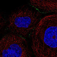 We did not find results for: Anti Desmocollin 3 Mouse Monoclonal Dsc3 U114 Purified Sample Ready To Use Quantity 600 Âµl Ready To Use