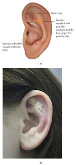 Check spelling or type a new query. Auricular Acupoints For Low Back Pain Treatment Download Scientific Diagram