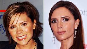 En ocasiones, cuando vemos un actor y lo vemos cambiado en su rostro, la mayoría de las personas. Bichectomia En Artistas Y Famosas Mira Quienes Se Operaron De Mejillas