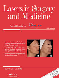 They are really good at fitting you in on short notice. Lasers In Surgery And Medicine Wiley Online Library