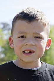 My Child S Tooth Just Got Knocked Out Best Ogden Dentist