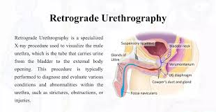 Image result for Retrograde Urethrogram