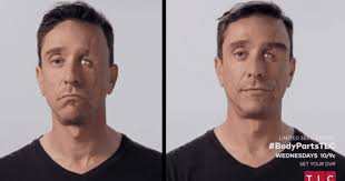 Body Parts': Allison Vest helps Daniel gain facial symmetry after car  accident