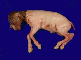 Bệnh toxoplasmosis