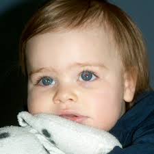 Strabismus encompasses a range of eye conditions in which the eyes are misaligned and/or do not move together. When Something Looks The Same As Nothing Strabismus Leukocoria And Childhood Eye Cancer We C Hope