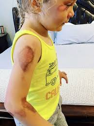 ER doctor shares tips following Alfonso Ribeiro's daughter's scooter  accident