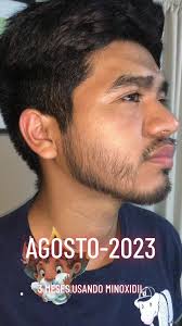 Arreglar Barba De Chivo