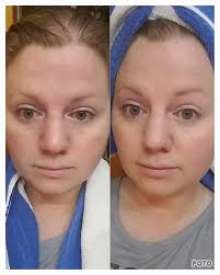 Can I see before and after pictures using the tinted Sun Shield as  foundation?