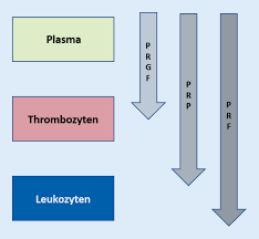 In applied mathematics, a dft matrix is an expression of a discrete fourier transform (dft) as a transformation matrix, which can be applied to a signal through matrix multiplication. Autologes Platelet Rich Fibrin Zur Unterstutzung Von Hart Und Weichgewebsheilung Springerlink