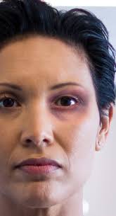 VIOLENCE AGAINST NURSES