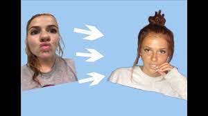How To Cure Chronic Ugliness - Youtube