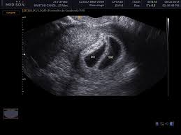 Em Busca Do Nosso Sonho Fevereiro 2013