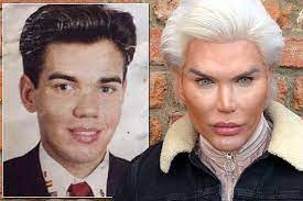 ken bebek lakapli rodrigo alves cinsiyet degistirdi guncel yasam haberleri