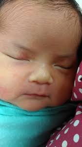 Check spelling or type a new query. Syazni Rahim Blog Pengalaman Bersalin Ceasarean Kali Ke 2 Pengalaman Dengan Foley Bulb