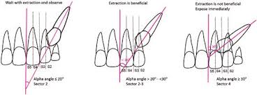 The breaking out of a rash on. Schematic Drawing With Cut Off Points For Sector And Alpha Angle Download Scientific Diagram