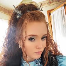 This is the second time I've had this redness and swelling after my hyqvia  infusion (and only my second full dose of medication, this is all new to  me). Is this a “