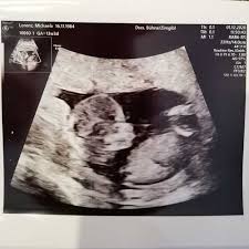 Ssw nimmt der bauchumfang deutlich zu und spätestens jetzt wird der kauf von. 19 20 Schwangerschaftswoche Infos Und Tipps Meinbaby123