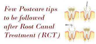 An alternative to standard root canal treatment, the gentlewave® procedure, uses a minimally invasive 1 approach to accessing and cleaning the root canal. Root Canal Aftercare Tips