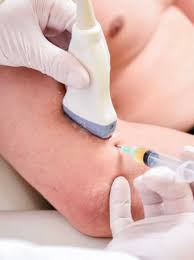 Image result for Knee Joint Injection