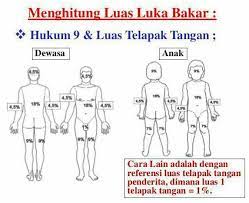 Luka bakar sendiri adalah adanya kerusakan jaringan yang di akibatkan dari terapaparnya dengan bahan panas. Contoh Soal Uji Kompetensi Keperawatan Spesial Luka Bakar Part 153 Ukom Perawat Ners