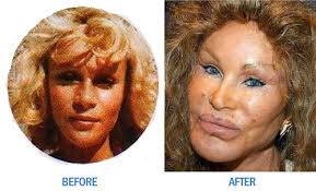 Plastic Surgery