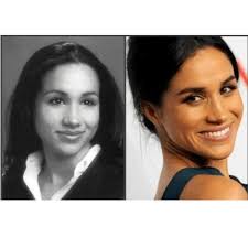 Meghan, duchess of sussex, урождённая рэ́йчел ме́ган маркл англ. Chtoby Privlech Princa Garri Megan Markl Sdelala Rinoplastiku