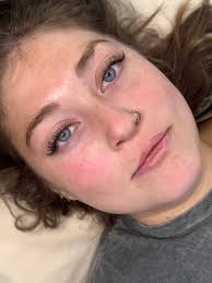 Columbus Esthetician Offers Discounts