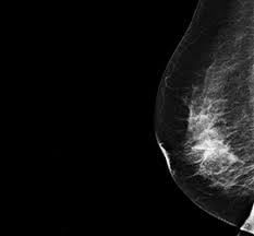 Proceduri stricte de triaj si cele mai severe masuri de igienizare si dezinfectie. Centrul De Imagistica Baneasa Reginamaria Ro