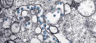 Reported cases and deaths by country or territory. Global Health Experts Advise Who To Identify Animal Source Of Covid 19 Virus Un News