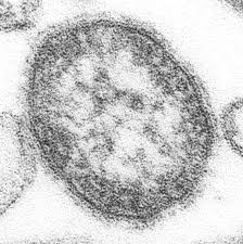 File:Measles virus.JPG - Wikipedia