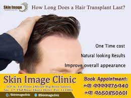 How Long Does A Hair Transplant Last Hair Transplant Skin Images Hair Transplant Procedure