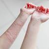 Nak letak krim ke minyak, apa cara hilangkan gatal badan ni? Https Encrypted Tbn0 Gstatic Com Images Q Tbn And9gcrdbfkssjbj57vftwlfxm3bsuzuxh 47dogfxgdjxt0z3kvqf Usqp Cau